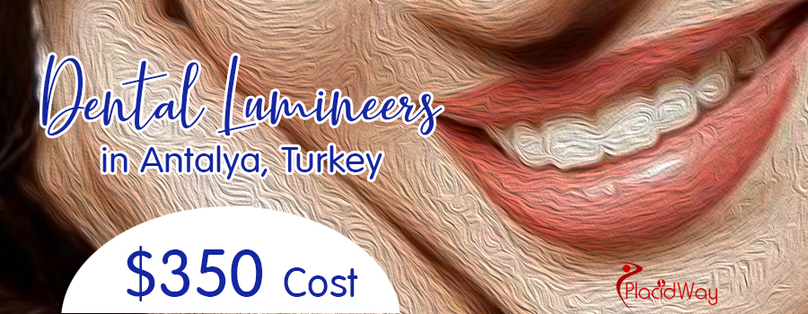 Dental Lumineers cost in Antalya, Turkey